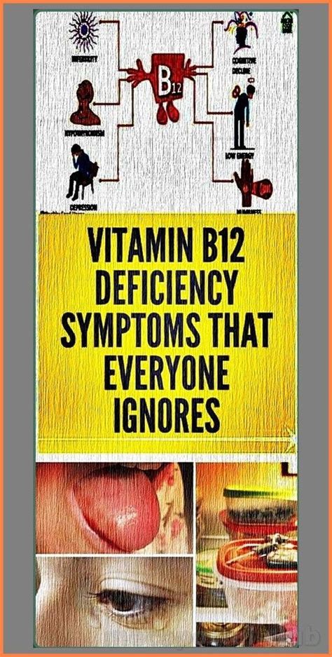 Warning Signs Of Vitamin B Deficiency You Should Never Ignore Artofit