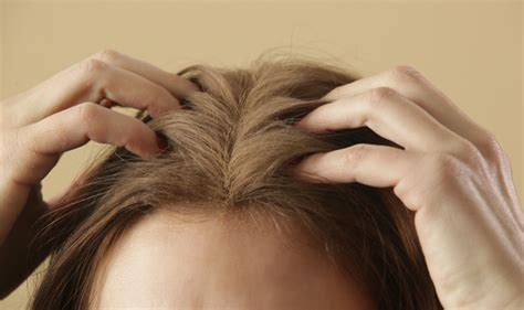 Dry Scalp Symptoms Causes Diet And Treatment Divi