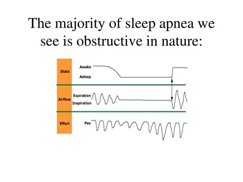 Ppt Central Sleep Apnea In Adults Causes And Treatment Powerpoint