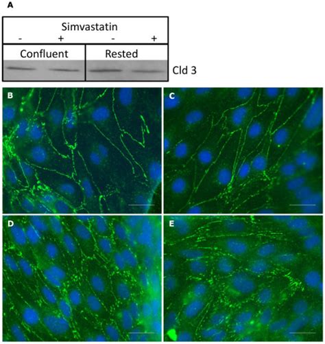 Influence Of Simvastatin On Hcmec D3 Confluent And Rested Monolayers Download Scientific