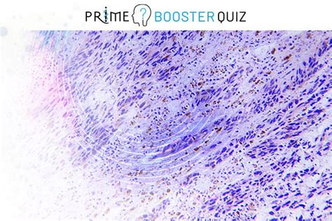 PRIME® Novel Immunotherapeutic Approaches in Advanced Melanoma