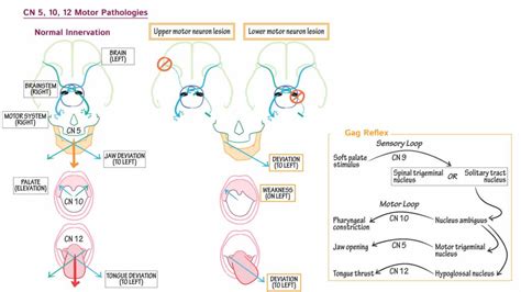 Extremely Sensitive Gag Reflex Causes And How To Manage Overly Sensitive Gag Reflex