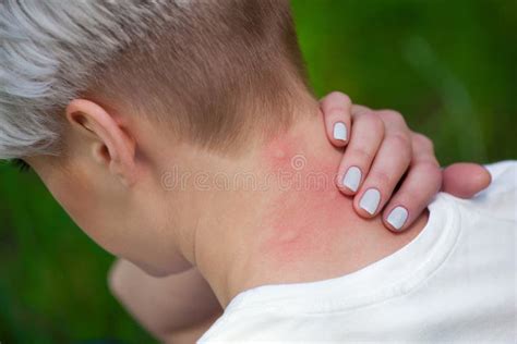 Girl With Blond Hair Sitting With His Back Turned And Scratching