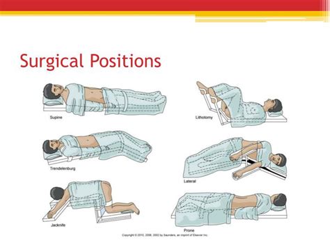 Surgical Positions Chart