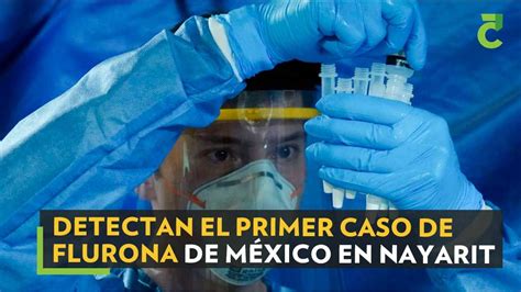 Detectan el primer caso de Flurona de México en Nayarit