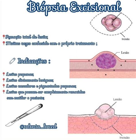 Bi Psia Excisional Cirurgia