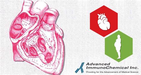 Cardiac Troponin T Ctnt Early Marker Of Acute Myocardial Infarction