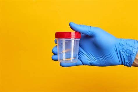 Navigating Random Drug Testing A Comprehensive Guide