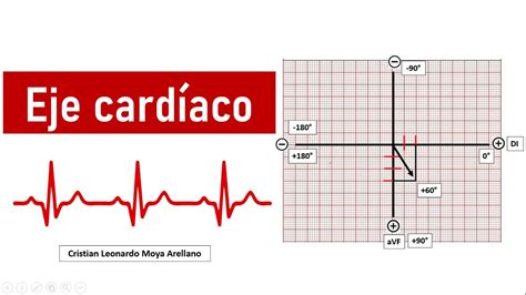 Electrocardiograma C Mo Calcular El Eje Card Aco Youtube