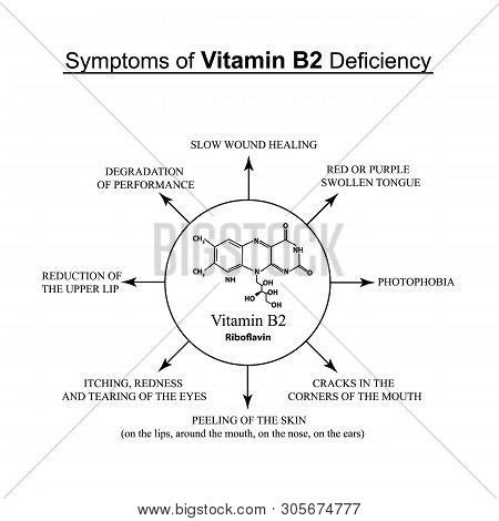 Symptoms Vitamin B2 Vector & Photo (Free Trial) | Bigstock