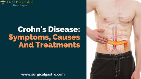 Crohn S Disease Symptoms Causes And Treatments Best Gastro Surgeon In