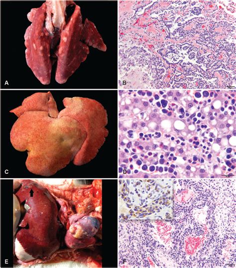 Spontaneous Neoplasms In Captive Virginia Opossums Didelphis