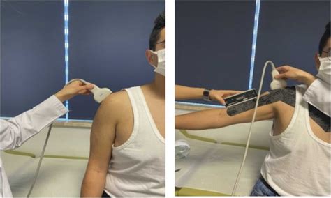 Immediate Effects Of Kinesio Taping And Dynamic Taping On