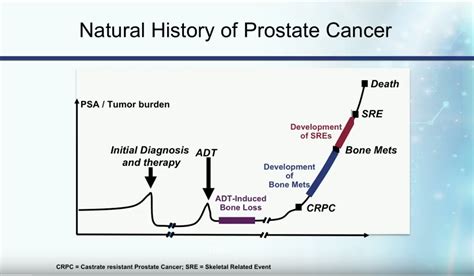 Prostate Cancer Natural Treatment Options