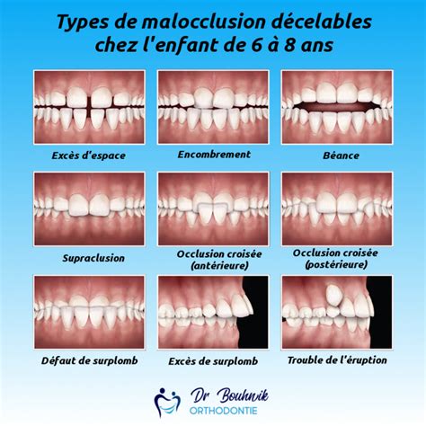 Tout Savoir Sur L Orthodontie