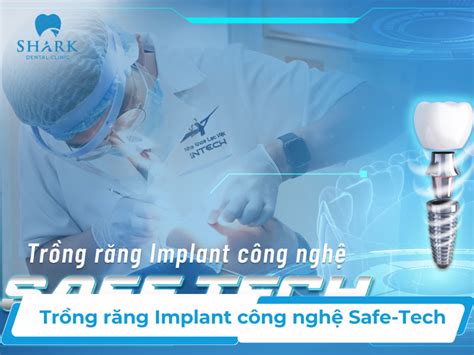 Trồng răng Implant công nghệ Safe Tech và 4 ưu điểm nổi bật