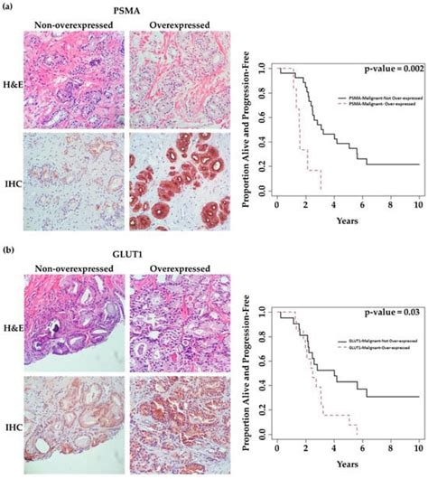 Ijms Free Full Text Prostate Specific Membrane Antigen Psma