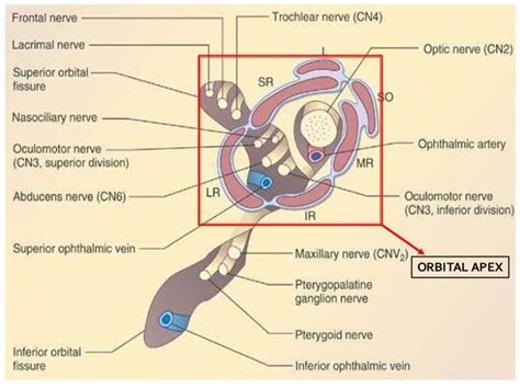 Orbital Apex Syndrome