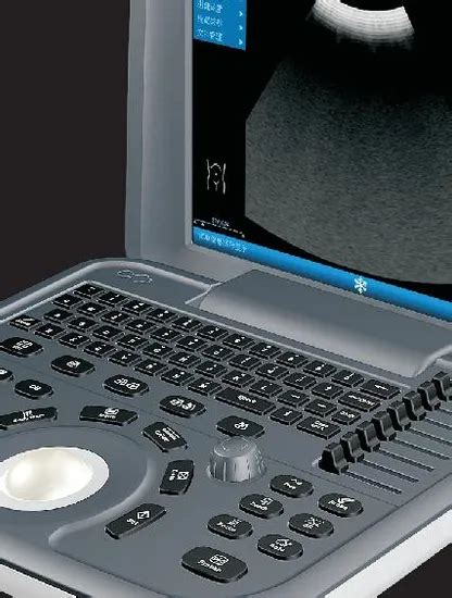 Portable Digital Ultrasonic Diagnostic System Ultrasound Scanner And