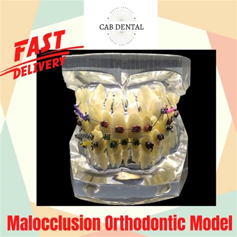 Malocclusion Orthodontic Demonstration Model Lazada Ph