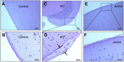 Histopathology of representative H&E-stained brain sections from mice ... 