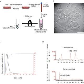 Characterization Of Evs Isolated By Ultracentrifugation A Schematic