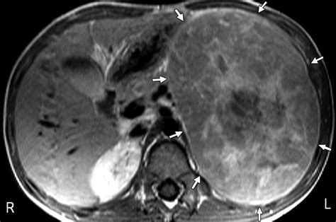 Integrated Imaging Using Mri And Metaiodobenzylguanidine