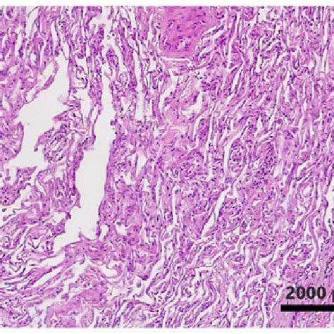 Hematoxylin And Eosin Staining Original Magnification X100