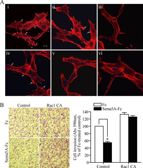 Semaphorin 5A And Plexin B3 Inhibit Human Glioma Cell Motility Through