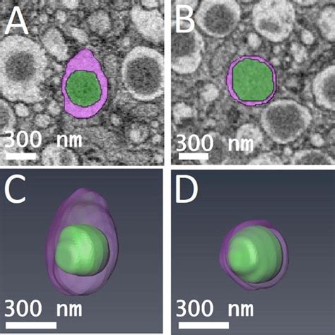 Segmented orthoslices of A mature β cell secretory granule and B