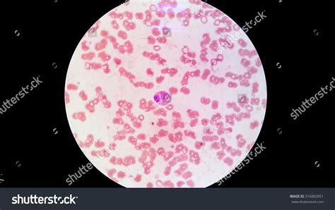 Blood Smear Under Microscope Stock Photo 316902851 | Shutterstock