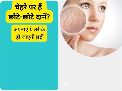 Skin Care Tips Home Remedies To Remove Small Pimples On Face Skin Care