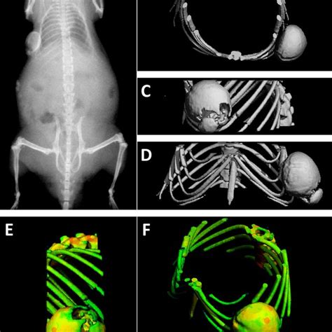 Microct Images And Analysis Of Reconstructed Rat Calvarial Defects In