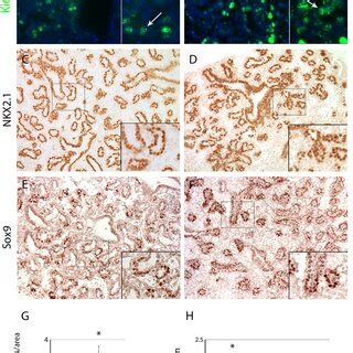 Mouse Ex Vivo Lung Culture Right Middle Lobe Organ Culture With