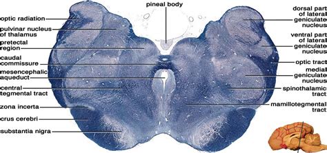 Pretectal Region