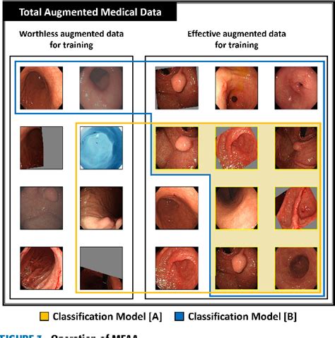 Figure 3 From Enhanced Classification Of Gastric Lesions And Early Gastric Cancer Diagnosis In