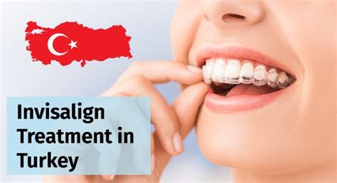 Invisalign Treatment In Turkey MedicaSmile