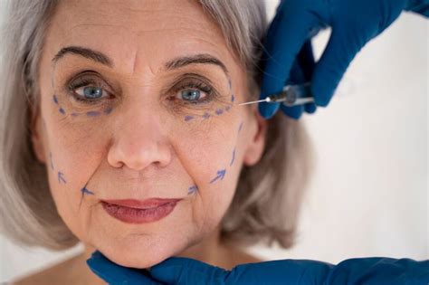 Sanfte ästhetische Behandlungen mit Hyaluron Botox