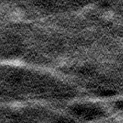 In-focus tomosynthesis slice at the central plane of lesions embedded ...