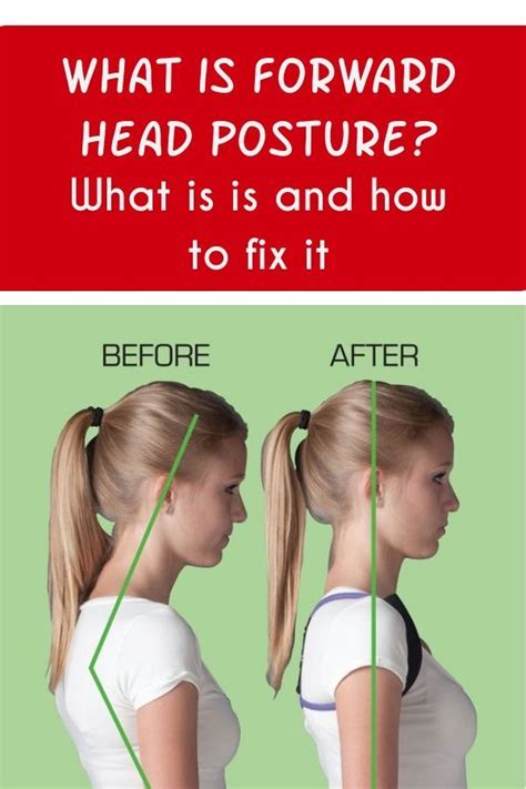 How To Correct Forward Head Posture Forward Head Posture Correction