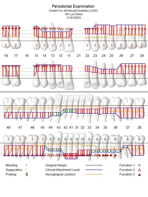 PERIO CHARTING