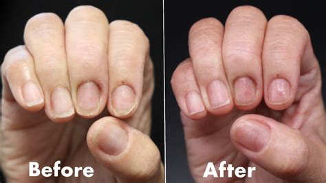 How To Fix Damaged Thin Brittle Nails Natural Nail