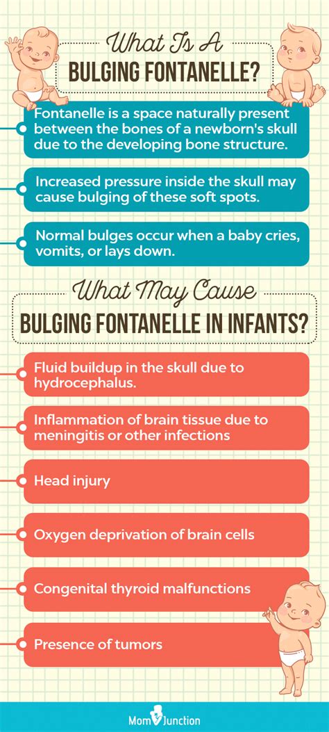 Bulging Fontanelle: Causes, Treatment When To See A Doctor, 48% OFF