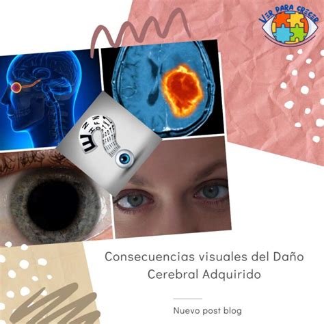 Daño Cerebral Adquirido en la visión Ver Para Crecer