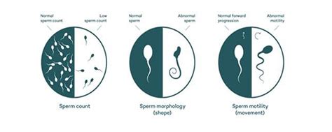 Male Fertility Vistana Fertility Centre