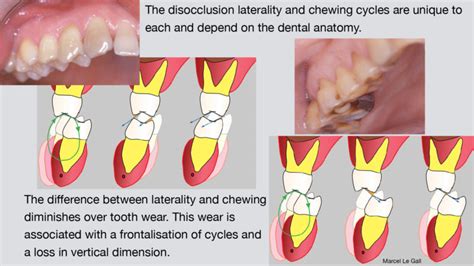 Mastication : Classical Concepts – OCCLUSAL FUNCTION