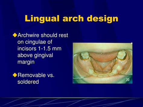 Ppt Passive Space Control Powerpoint Presentation Free Download Id