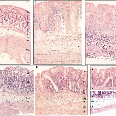 Representative Histological Sections Of Colon Tissues Of Balb C Mice