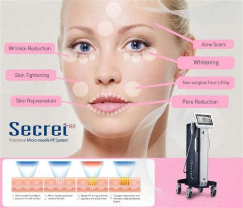 2025 New Ilooda Secret RF 2 0 Microneedling Radio Frequency With 3