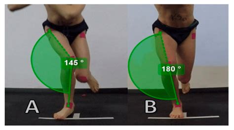 Example Of Dynamic Knee Valgus Knee Move Inwards From Foot Position A